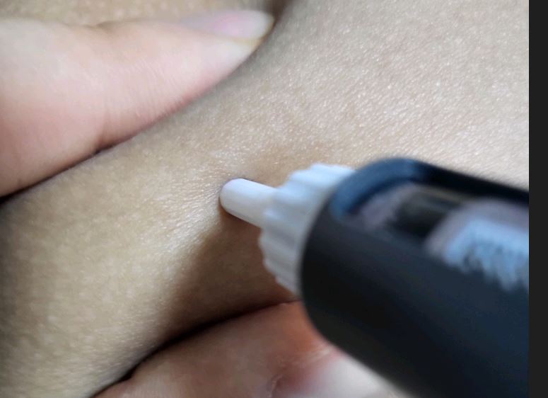 공갈주사 놓는 법 사진